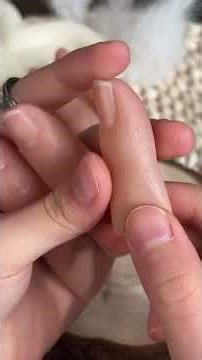 #Hot topic #Aesthetic silicone fingers #Prosthetic finger
