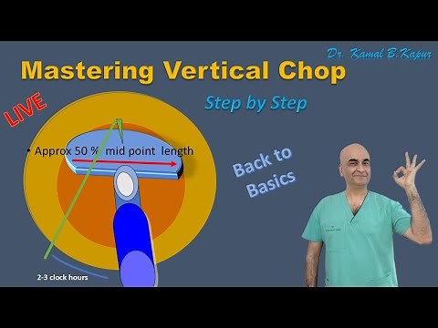 Mastering a VERTICAL Chop - Step by step ( Back to Basics) -Dr Kamal B. Kapur