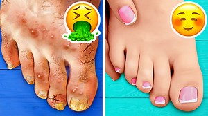 1.3M views · 5.8K reactions | How to do pedicure at home like a pro.禮 Cool beauty procedures that will change your life! | 5-Minute Crafts Like | Facebook