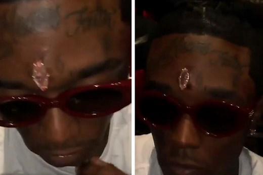 Why did Lil Uzi Vert get a pink diamond implanted in his forehead?