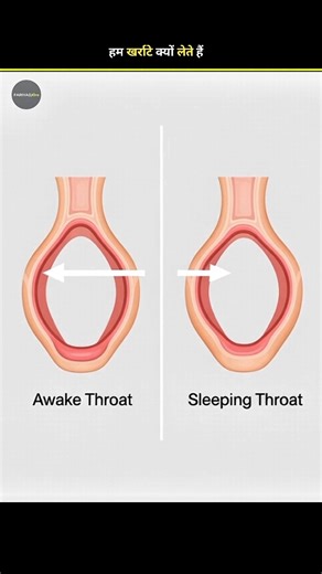 Why do we snore? #shorts #shortsfeed #ytshorts