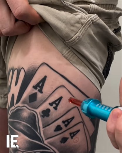 Comfort-In is a needle-free injector using pressure to deliver medication through the skin painlessly. 🎥 needle_free / IG | Interesting Engineering