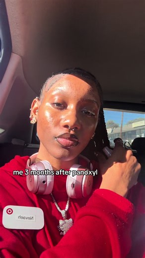 Effective Skin Care Routine Using PanOxyl