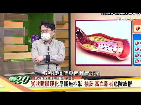 粥狀動脈硬化早期無症狀 抽菸.高血脂者危險族群 健康2.0