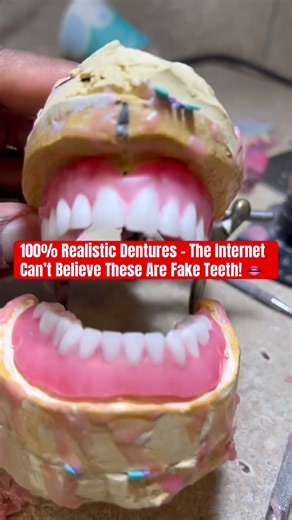 100% Realistic Dentures – The Internet Can’t Believe These Are Fake Teeth! 👄#dentures #teethdecay