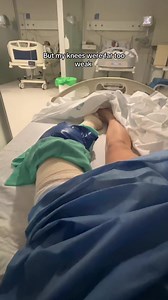 Operación de Rodilla LCA: Recuperación y Cuidados