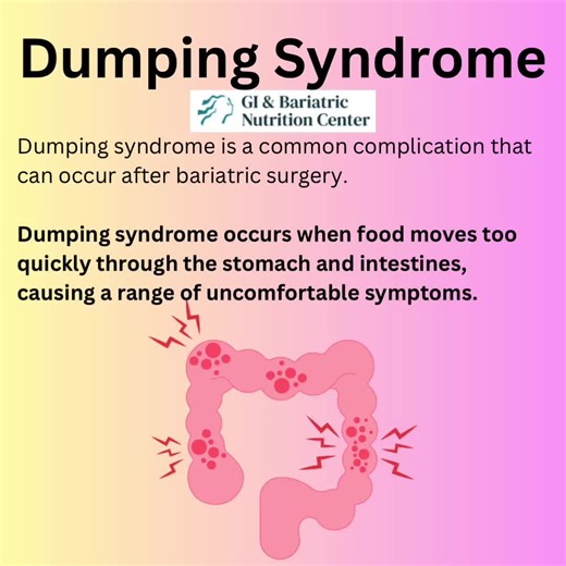 Understanding and Managing Dumping Syndrome After Bariatric Surgery
