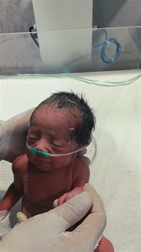 First Moments After C-Section 👶 | Newborn Greeting & Care