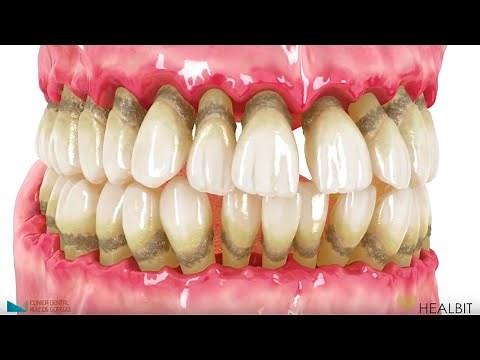 La importancia de la Higiene Oral