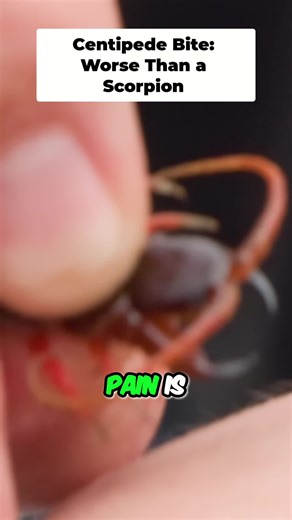Centipede Bite vs Scorpion Sting: Painful Comparison