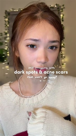 Erase Dark Spots and Acne Scars with Blithe Niacinamide