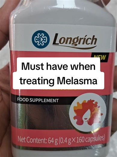 Essential Tips for Managing Melasma Effectively