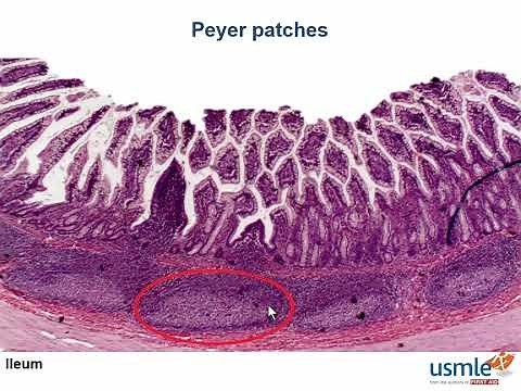 USMLE-Rx Express Video of the Week: Peyer Patches