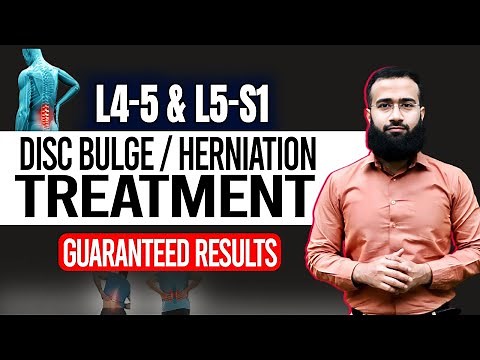Get Rid Of L4 L5 And L5 S1 Disc Bulge With This Home Treatment | Guaranteed Results!