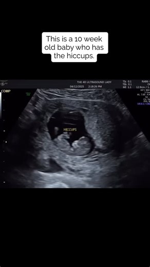 1.6K views · 89 reactions | This 10 week old baby deserves life. 懶 | Illinois Family Institute | Facebook