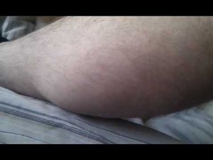 1) Issac's Syndrome (Neuromyotonia) - Peripheral nerve hyperexcitability - Muscle Twitching