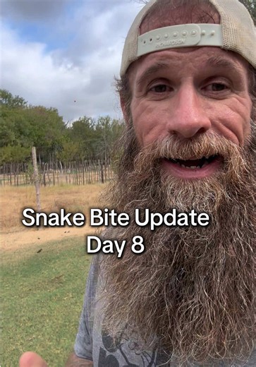 I just wanted to share what was in my heart this morning. #ClearCreekAdventureRanch #VenomousSnakeBite #Grace #NeverGiveUp #InspireKindness