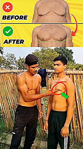 2.7M views · 5.7K reactions | Chest Gyno Or छाती की चर्बी ko Aise khatam kare ✅ . . . . . . . . . . . . . . . . . . . . . . #chest #workout #trending #fitness #athlete #tutorial #homeworkout #weightloss | Ravi Raj | Facebook
