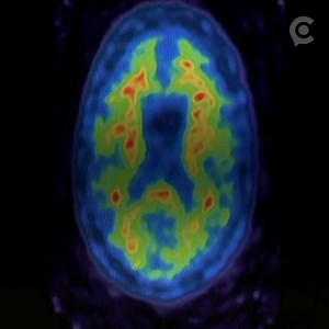 110K views · 77 reactions | Scientists say they've developed a test,...