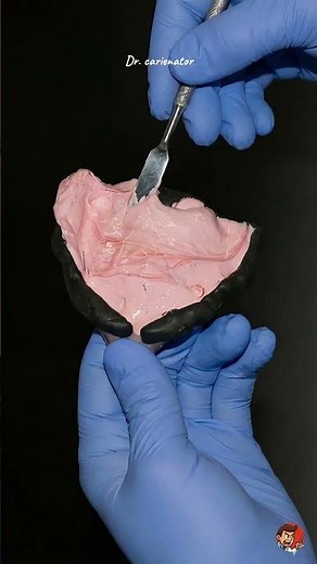 How Dentures Are Actually Made 🦷