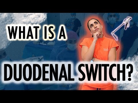 What is Duodenal Switch / SADI-S - Dr Sandy - Bariatric Surgeon
