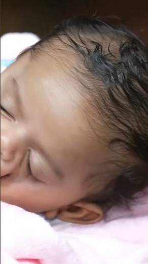 Rare birth defect baby pre Consultation for surgery