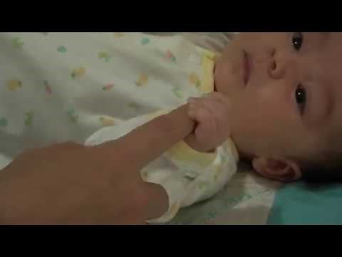 3. Palmar Grasp Reflex