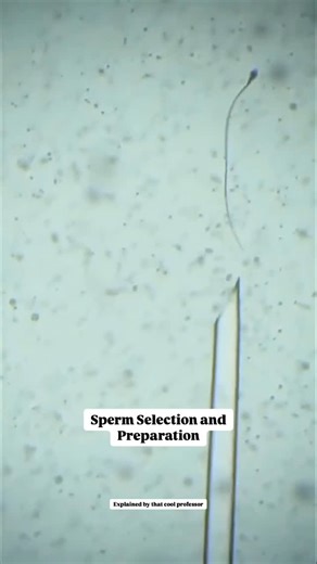 Abhay Mishra | Academic Advisor on Instagram: "Follow🎖️Understanding the Science Behind Test Tube Babies! 🌟 To read more “Human Assisted Reproductive Technology” and “Textbook of Assisted Reproductive Techniques”. Ever wondered how a test tube baby is made? Let’s break it down in easy steps! 👶🔬 Sperm Selection 🧬 Healthy sperm are selected and prepared for fertilization. Intracytoplasmic Sperm Injection (ICSI) 💉 A single sperm is injected directly into the egg. No barriers, just fertilizati