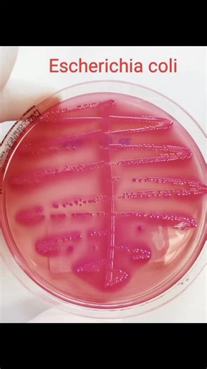 Rose Apple on Instagram: "🦠🦠Gram Negative Bacilli 🦠🦠 " These common Gram Negative Bacilli have a distinctive appearance that allows for immediate preliminary identification " ☺️😊🥰 🌹Escherichia Coli🌹 🔸MacConkey Agar : Lactose fermentation ( cloudy zone around the colonies — often referred to as bile salt precipitation ) 🍁Klebsiella Pneumoniae🍁 🔸 Mac Conkey agar : Mucoid Lactose Fermentation 🌺 Proteus Mirabilis🌺 🔸 Blood Agar : Swarming Pattern 🔸 Oxidase : Negative 🔸 Strong, charac