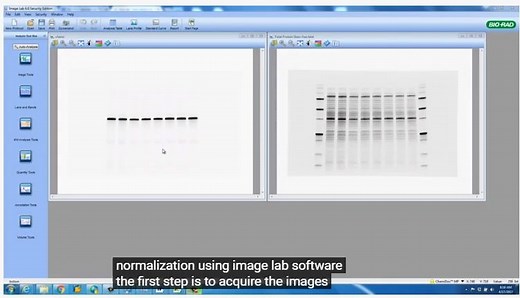搬运【蛋白质】ImageLab软件快速分析WB结果