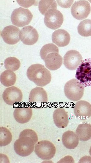 だいたひかるの蜂窩織炎について知る豆知識