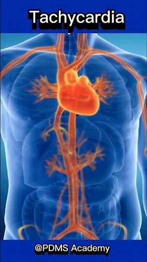 Tachycardia | Fast Heart rate | symptoms and causes #medicine