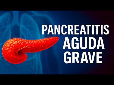 Pancreatitis aguda grave