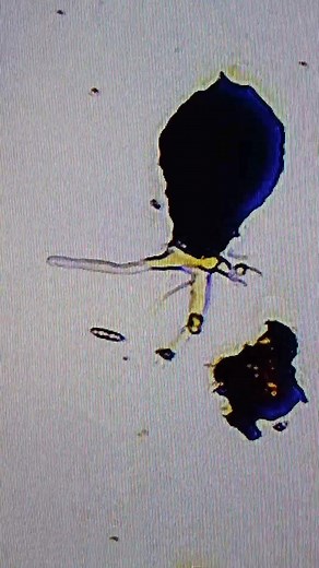 Difflugia? | Belorix Belisames