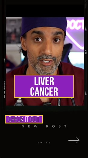 How is liver cancer detected and diagnosed. #liverdisease #nash #mash #nafld #doctor | Zain Hasan