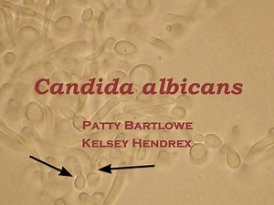 Candida albicans - SlideServe