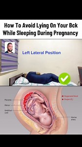 289K views · 5.4K reactions | How to prevent lying on you back when sleeping during advanced pregnancy. | Dr.Moyub Healthcare | Facebook