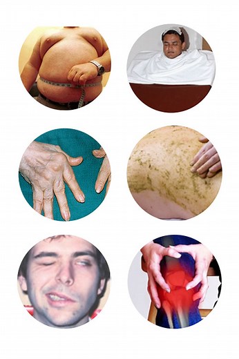 Kaya Chikitsa - Get general medicine consultation in Ayurveda