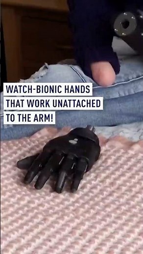 Bionic hands that work unattached to the arm