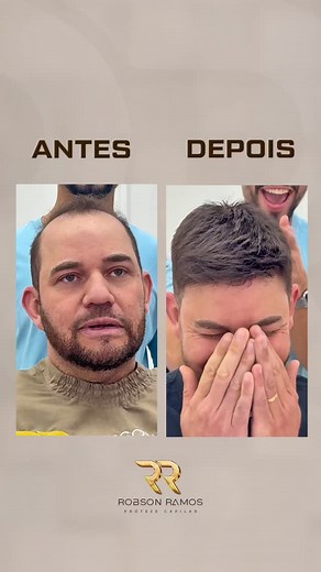Um novo visual, uma nova energia. Cada transformação aqui é mais do que estética — é vida voltando para o lugar certo. ✨ 💻 rrprotesecapilar.com.br 📞 (19) 99664-3334 | RR - Prótese Capilar