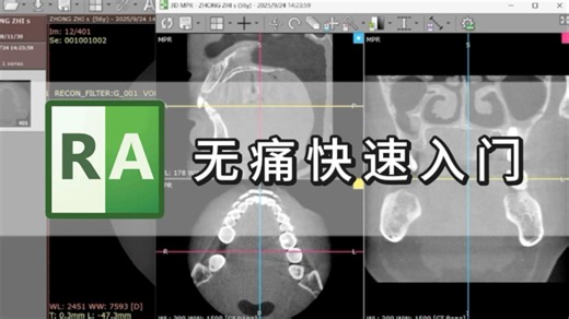 RadiAnt DICOM Viewer基础使用