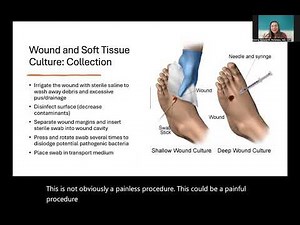 Microbiologic Testing: Wound and Soft Tissue Culture