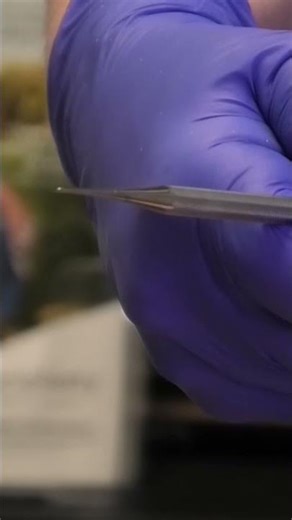 Trimming Nails Shouldn't Be This Hard #MyastheniaGravis #FatigueIsReal