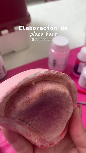 Elaboración de Placas Base en Odontología