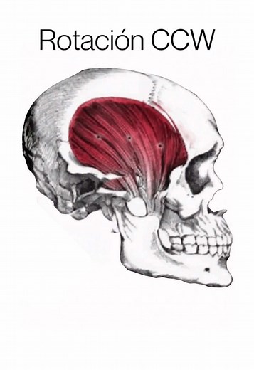 Rotación CCW 👇🏼 En la ciencia del desarrollo facial, la rotación CCW (Counter Clock-Wise), quiere decir un crecimiento del rostro en sentido opuesto a las agujas del reloj ⏰, es decir, hacia arriba y adelante. Este es el tipo de crecimiento que buscan generar los cirujanos maxilofaciales, al intervenir en estructuras con dientes 🦷 torcidos y un pobre crecimiento mandibular. Sin embargo, este tipo de crecimiento puede obtenerse de manera natural, con: - Correcta postura de la lengua - ⁠Ejercic