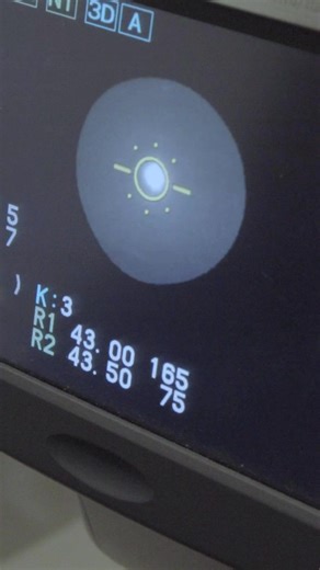 👓 Kids don’t always speak up when their vision changes—and regular eye exams can make a big difference. We’re breaking down why eye checks matter, what to watch for, and how early detection supports kids at home and at school. | SavvyMom