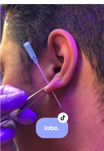 Experience Faster, Cleaner Ear Piercings with a Needle