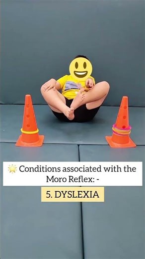 Understanding the Moro Reflex: Supporting Neurodevelopmental Challenges