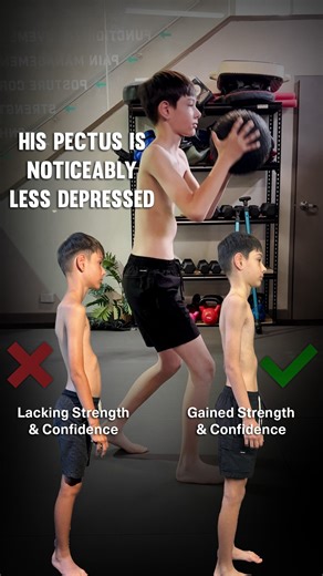 Functional Patterns on Instagram: "One of the best things you can do in life is getting ahead of problems. It’s even better when you can do it for your kids and family. This is what Anthony’s mom was able to do for him by getting him started on FP. She was worried about his pectus excavatum. It wasn’t getting any better on its own. Check out what 8 months of FP did for Anthony 👇 “My son started weekly training with Alana because we were concerned about his pectus excavatum. In the last 8