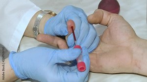 Taking blood for close-up analysis, a clinical blood test. Blood chemistry. Medical laboratory technologist taking a blood sample from patient.